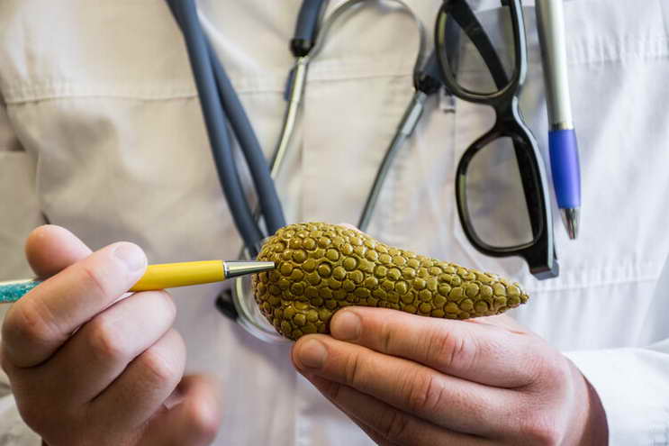 有一種致命的誤診，叫“把胰腺癌當胃病”，4個症狀要摸清楚