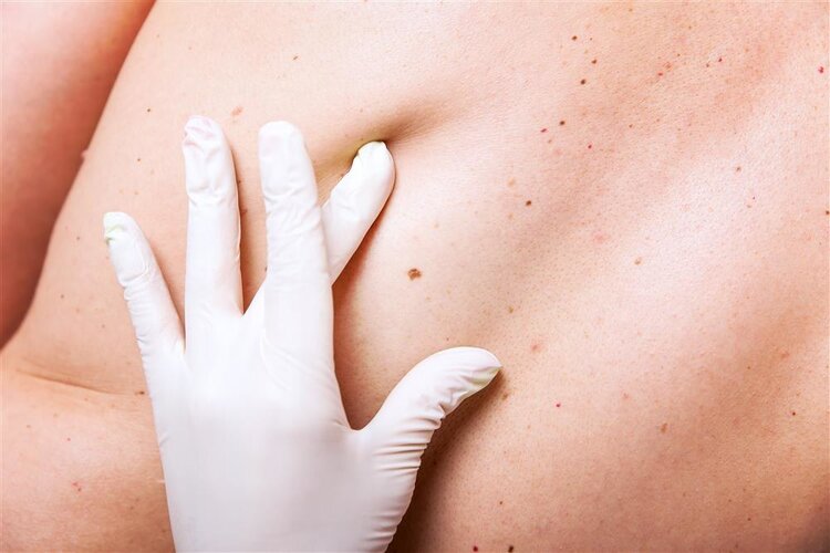 乳房肿块不疼不痛？不可能是乳腺癌？ 5点病症别轻视